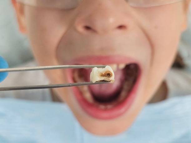 Best Pediatric Emergency Dentist in Fort Worth, TX